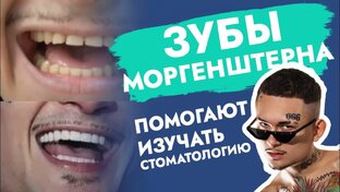 Какие зубы у ... ?