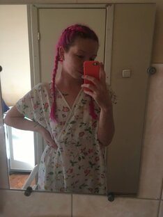 Синдром Лайелла