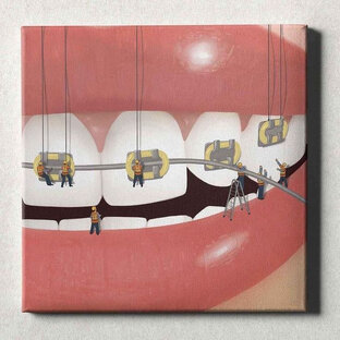 исправление прикуса 