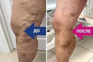 Результат лечения нашего пациента