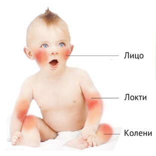Детское здоровье