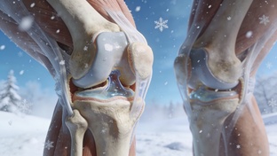 Здоровье суставов зимой