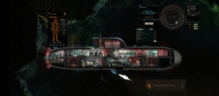 Barotrauma