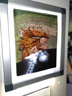 Вышивка на рентгеновском снимке