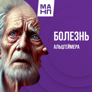 Болезнь Альцгеймера