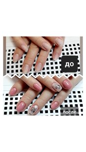 Корекцыя ногтей