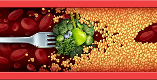 Статины и бляшки )))