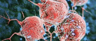 Новообразования 