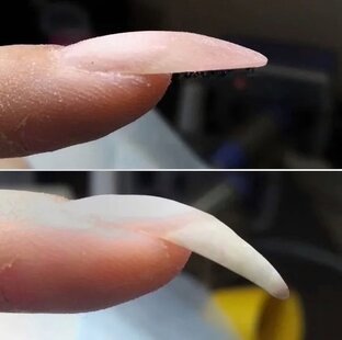 Клюющие ногти проблема всех девушек