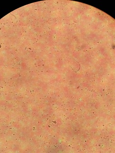 Жиры бактерии дрожжи и тд 