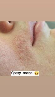 Волосы на усиках нужны тол ко котику 🫠