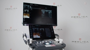 Mindray Consona N9 - мастер-классы на УЗИ аппарате