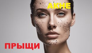 ЧИСТКА Лица от ПРЫЩЕЙ АКНЕ Работает Beauty Косметолог