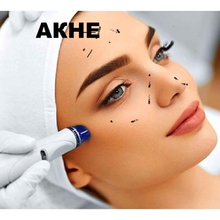 Удаление угрей. Лечение угревой сыпи и очень приятное. Появление прыщей №1