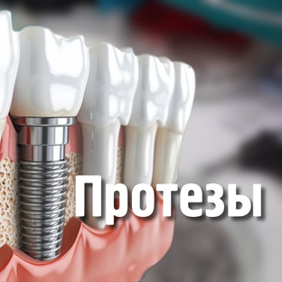 Протезирование