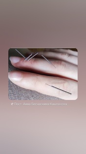 Здоровье,профилактика