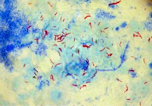 Микробиология