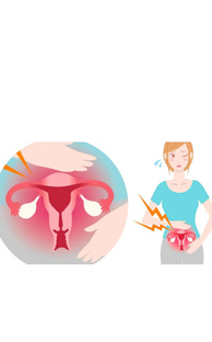 Хронический эндометрит 