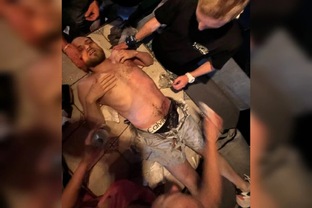 Выжил после удара молнии