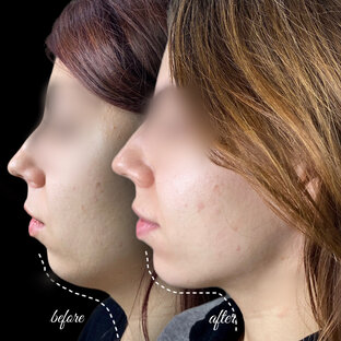 Моделирование лица