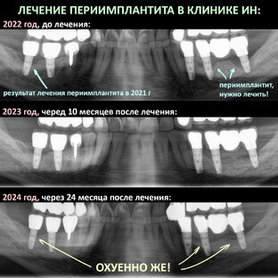 Инсты и Марвелы