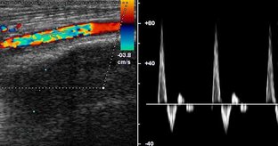 Проктология