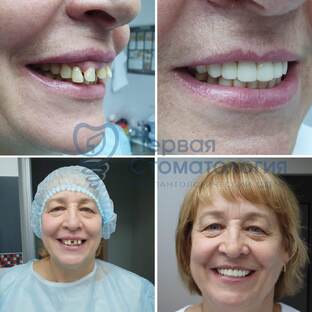 Истории пациентов. Отзывы.