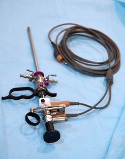 Гистероскоп и гистероскопия