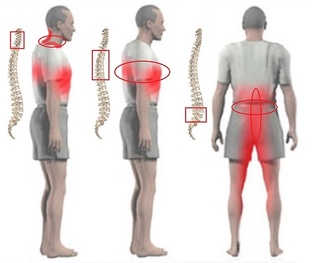 ЛФК и тренировки при боли в спине