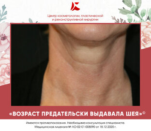 Маркеры старения - кожа шеи. 