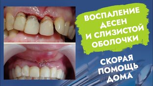 скорая помощь