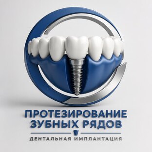 Протезирование зубных рядов (имплантация)