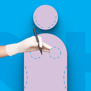 Пластическая хирургия