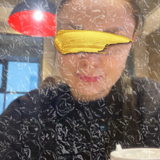 Дисморфофобия 