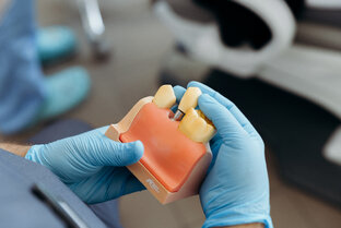 Имплантация