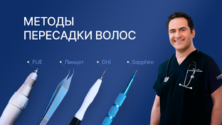 Статьи о пересадке волос