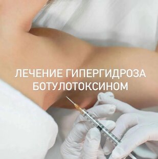 ЛЕЧЕНИЕ ГИПЕРГИДРОЗА