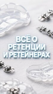 ВСЁ О РЕТЕНЦИИ И РЕТЕЙНЕРАХ