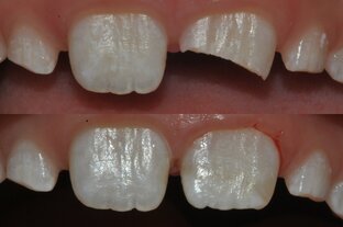 Экстренное