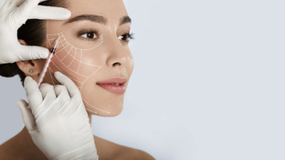 Ботулинотерапия 