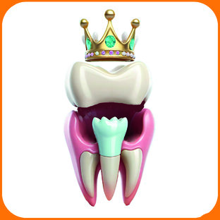 Протезирование зубов