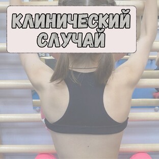 Клинические случаи из практики