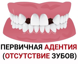 АДЕНТИЯ РЕЗЦОВ