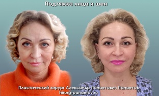 О пластической хирургии