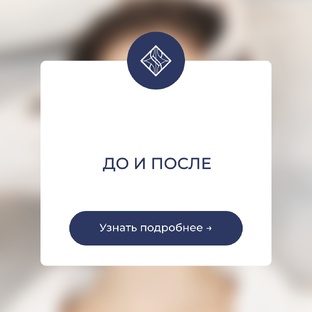 До и После 