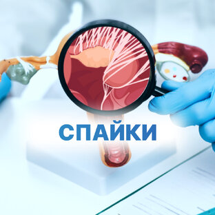 СПАЙКИ