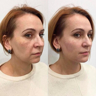 Результаты