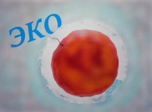 Процедура ЭКО