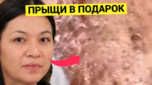 Обзоры косметологических процедур