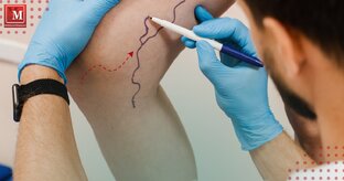 Флебология